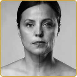 Anti-Aging